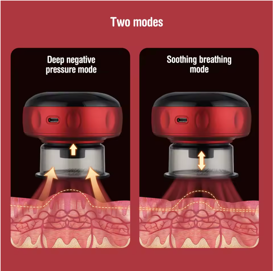 Relieve Electric Cupping Massager® - Effective Pain Relief & Muscle Recovery